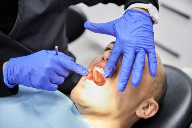 Best Mobile Emergency Dentist in Carrington, ND