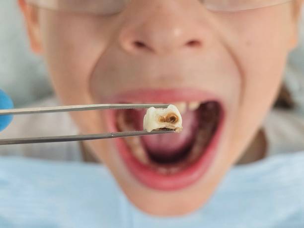 Best Orthodontic Emergency Dentist in Carrington, ND